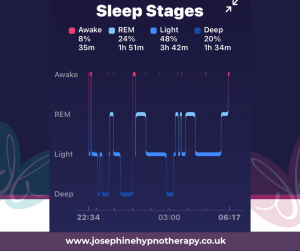 Sleep cycles 