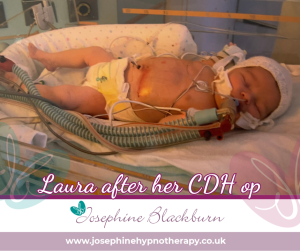 photo of Laura after her CDH op. Hypnotherapy helped my birth trauma